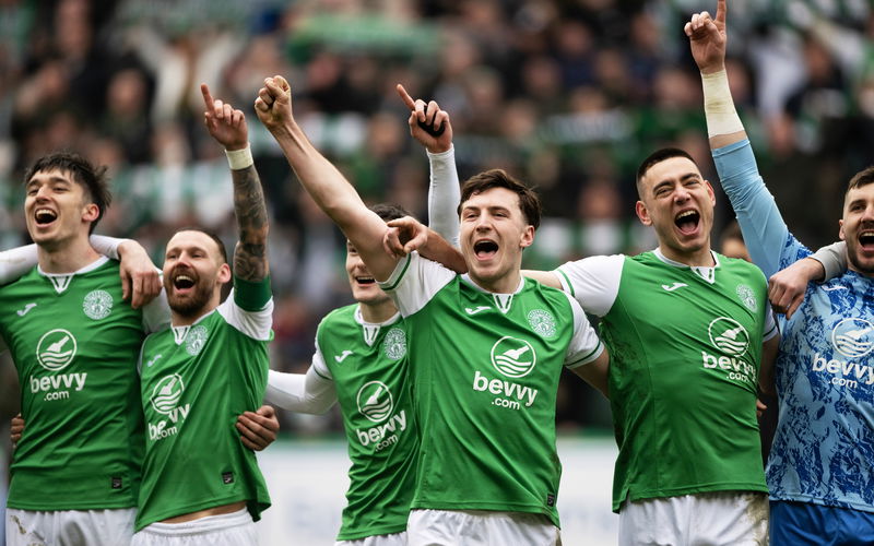 Image for Celtic has a real game on its hands next weekend. Hibs are Scotland’s other on form team.