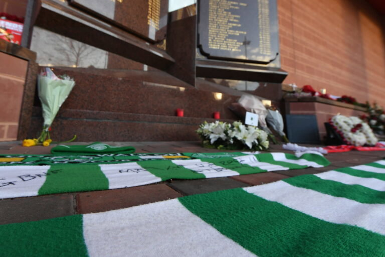 Liverpool FC v Celtic Legends