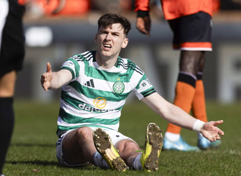 Celtic did not lose at Tannadice because the pitch was shit.